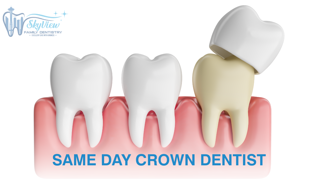 Same Day Crown Dentist: Fast, Reliable Restoration at Skyview Family Dentistry
