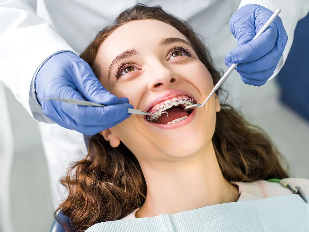 It Is Not Too Late for Braces: Adult Orthodontics With Modern Options